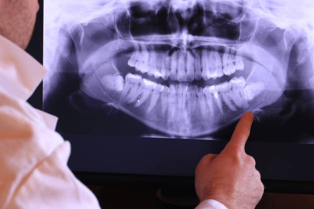 Best Pediatric Emergency Dentist in Center Point, TX